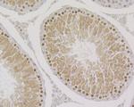 SMN1 Antibody in Immunohistochemistry (Paraffin) (IHC (P))