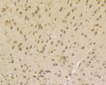 SMN1 Antibody in Immunohistochemistry (Paraffin) (IHC (P))