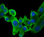 STUB1 Antibody in Immunocytochemistry (ICC/IF)