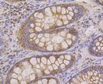 HSPE1 Antibody in Immunohistochemistry (Paraffin) (IHC (P))