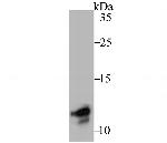 TYROBP Antibody in Western Blot (WB)