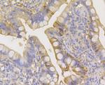 Carbonic Anhydrase I Antibody in Immunohistochemistry (Paraffin) (IHC (P))