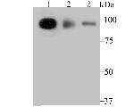 TNPO3 Antibody in Western Blot (WB)