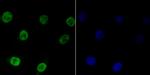 Bub3 Antibody in Immunocytochemistry (ICC/IF)