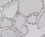 Bub3 Antibody in Immunohistochemistry (Paraffin) (IHC (P))