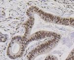 Bub3 Antibody in Immunohistochemistry (Paraffin) (IHC (P))