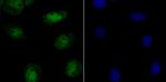 CAF1 p150 Antibody in Immunocytochemistry (ICC/IF)