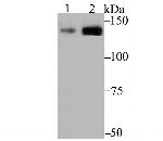 CAF1 p150 Antibody in Western Blot (WB)