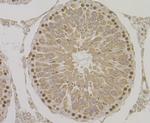 HYOU1 Antibody in Immunohistochemistry (Paraffin) (IHC (P))