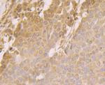 HYOU1 Antibody in Immunohistochemistry (Paraffin) (IHC (P))