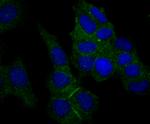 Nectin 2 Antibody in Immunocytochemistry (ICC/IF)