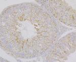 Nectin 2 Antibody in Immunohistochemistry (Paraffin) (IHC (P))