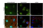 CtBP1 Antibody in Immunocytochemistry (ICC/IF)