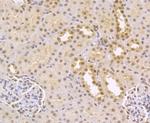 CtBP1 Antibody in Immunohistochemistry (Paraffin) (IHC (P))