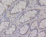 CtBP1 Antibody in Immunohistochemistry (Paraffin) (IHC (P))