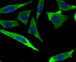 METAP2 Antibody in Immunocytochemistry (ICC/IF)