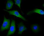 METAP2 Antibody in Immunocytochemistry (ICC/IF)