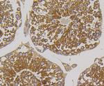 METAP2 Antibody in Immunohistochemistry (Paraffin) (IHC (P))