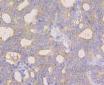 Monoamine Oxidase B Antibody in Immunohistochemistry (Paraffin) (IHC (P))