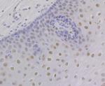 RXRA Antibody in Immunohistochemistry (Paraffin) (IHC (P))