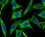 SNX1 Antibody in Immunocytochemistry (ICC/IF)