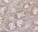 SNX1 Antibody in Immunohistochemistry (Paraffin) (IHC (P))