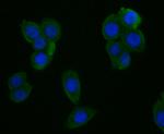 CYP27A1 Antibody in Immunocytochemistry (ICC/IF)