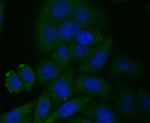 CYP27A1 Antibody in Immunocytochemistry (ICC/IF)