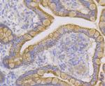 CYP27A1 Antibody in Immunohistochemistry (Paraffin) (IHC (P))