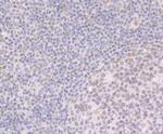BRD2 Antibody in Immunohistochemistry (Paraffin) (IHC (P))