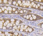 DIAPH1 Antibody in Immunohistochemistry (Paraffin) (IHC (P))