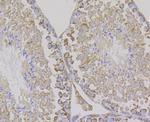 Aconitase 2 Antibody in Immunohistochemistry (Paraffin) (IHC (P))