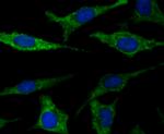 FIS1 Antibody in Immunocytochemistry (ICC/IF)