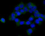 CBS Antibody in Immunocytochemistry (ICC/IF)