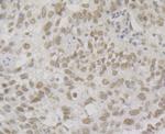 BAF57 Antibody in Immunohistochemistry (Paraffin) (IHC (P))