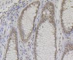 BAF57 Antibody in Immunohistochemistry (Paraffin) (IHC (P))