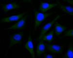 PEN2 Antibody in Immunocytochemistry (ICC/IF)