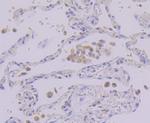 PEN2 Antibody in Immunohistochemistry (Paraffin) (IHC (P))