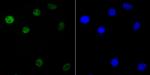 KHSRP Antibody in Immunocytochemistry (ICC/IF)