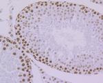 KHSRP Antibody in Immunohistochemistry (Paraffin) (IHC (P))