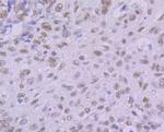 KHSRP Antibody in Immunohistochemistry (Paraffin) (IHC (P))