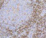 ADAP Antibody in Immunohistochemistry (Paraffin) (IHC (P))