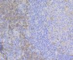 ADAP Antibody in Immunohistochemistry (Paraffin) (IHC (P))