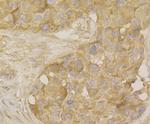 MARK3 Antibody in Immunohistochemistry (Paraffin) (IHC (P))