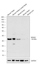 RPA2 Antibody