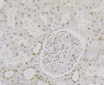 RPA2 Antibody in Immunohistochemistry (Paraffin) (IHC (P))