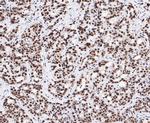 SAM68 Antibody in Immunohistochemistry (Paraffin) (IHC (P))