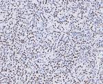 SAM68 Antibody in Immunohistochemistry (Paraffin) (IHC (P))