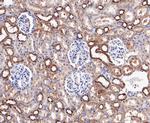 LYPLA1 Antibody in Immunohistochemistry (Paraffin) (IHC (P))