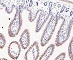 LYPLA1 Antibody in Immunohistochemistry (Paraffin) (IHC (P))